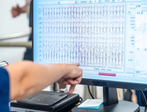 Randomized Controlled Trial of Physiology-Informed TMS (piTMS) for Major Depressive Disorder | Flavio Frohlich, PhD – Athena Stein, PhD | $199,991